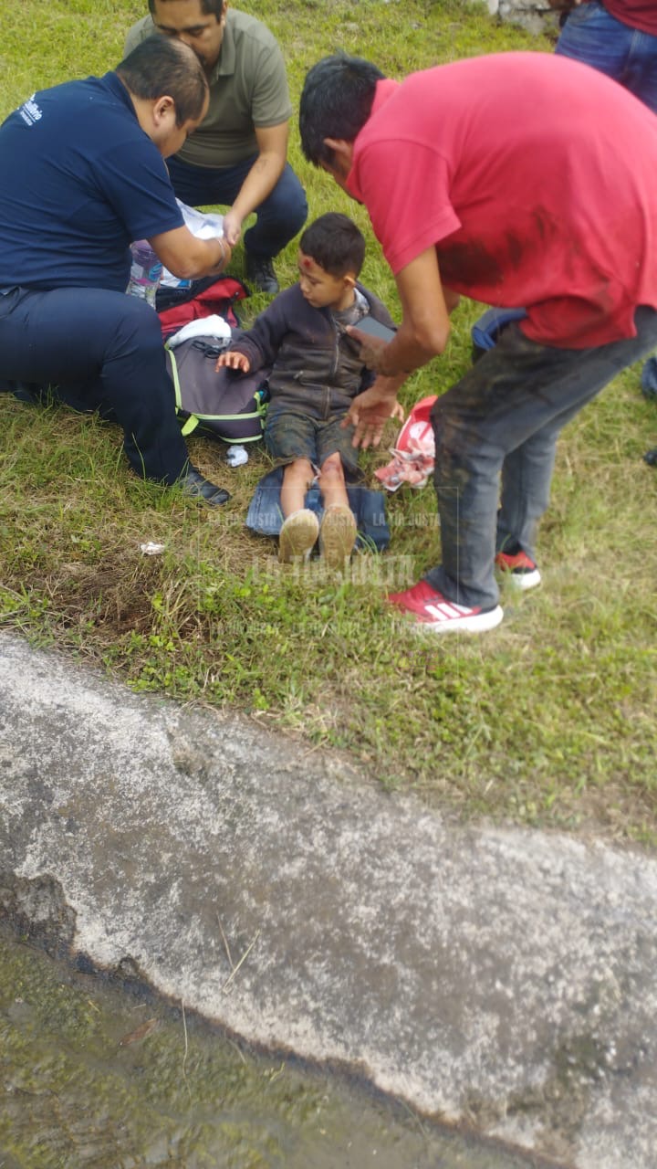 ACCIDENTE DEJA UN MENOR LESIONADO
