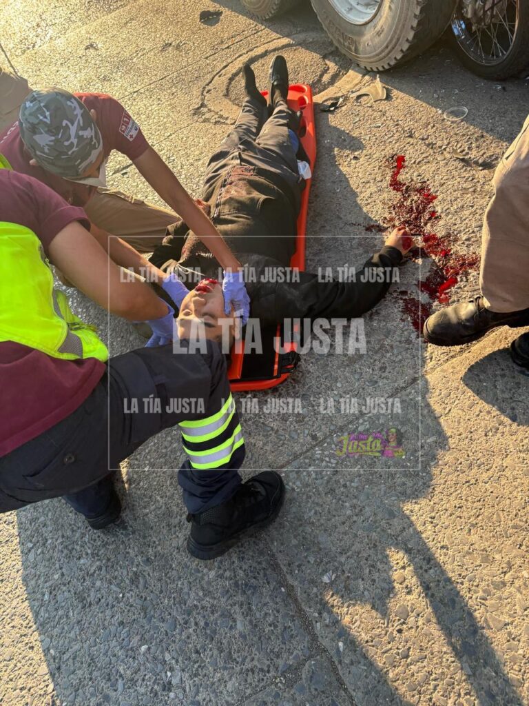 CHOCA CONTRA TOLVA Y RESULTA GRAVEMENTE LESIONADO