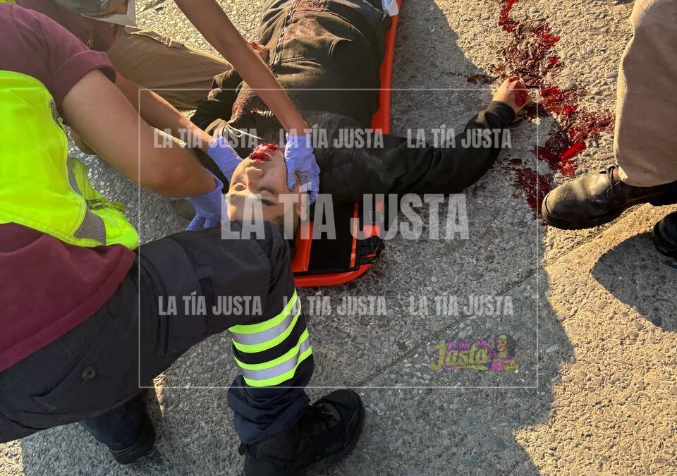 CHOCA CONTRA TOLVA Y RESULTA GRAVEMENTE LESIONADO