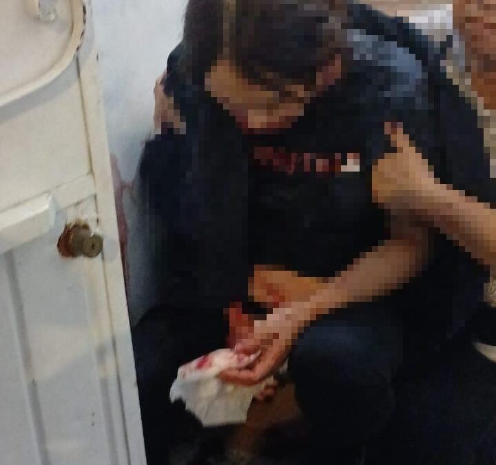 APUÑAL4 A SU PAREJA EMBARAZADA