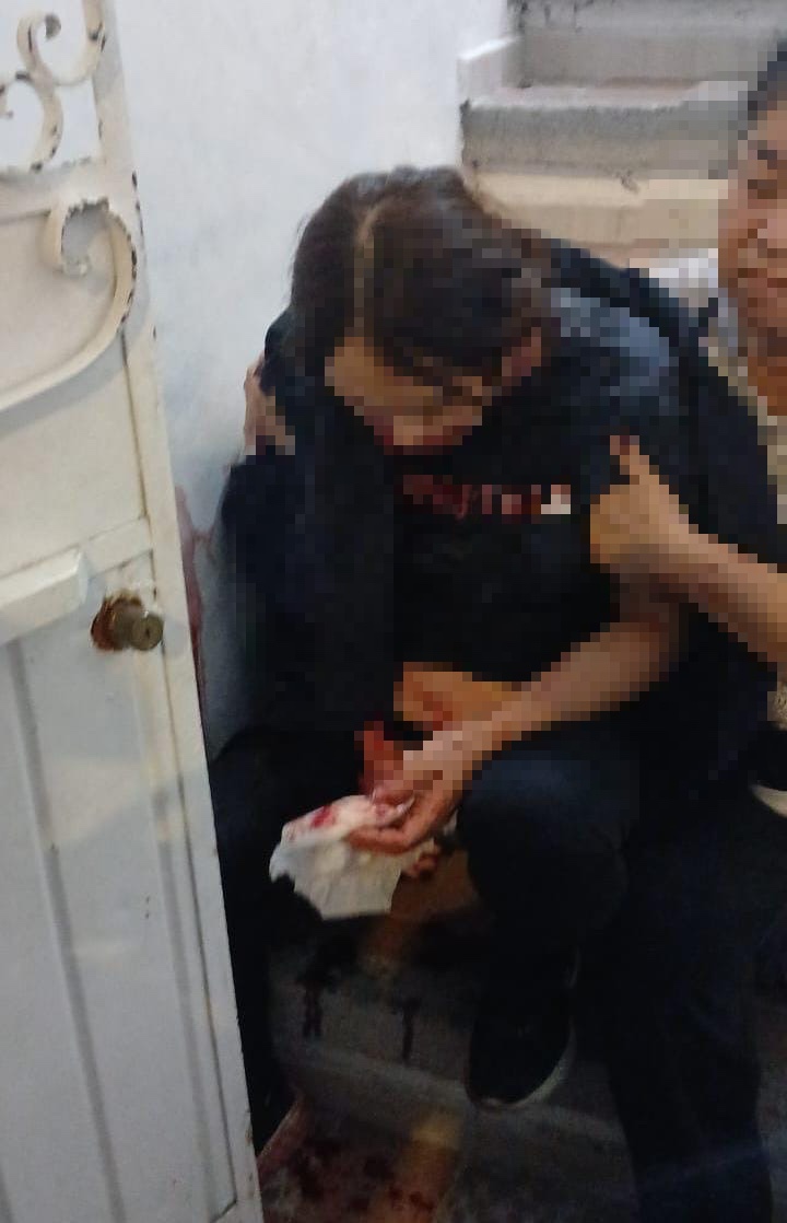APUÑAL4 A SU PAREJA EMBARAZADA