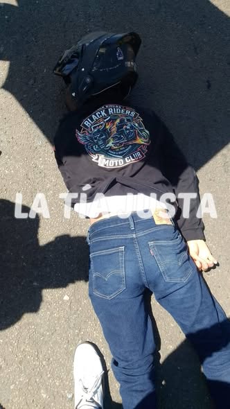MOTOCICLISTA DE 20 AÑOS RESULTA LESIONADO EN CHOQUE