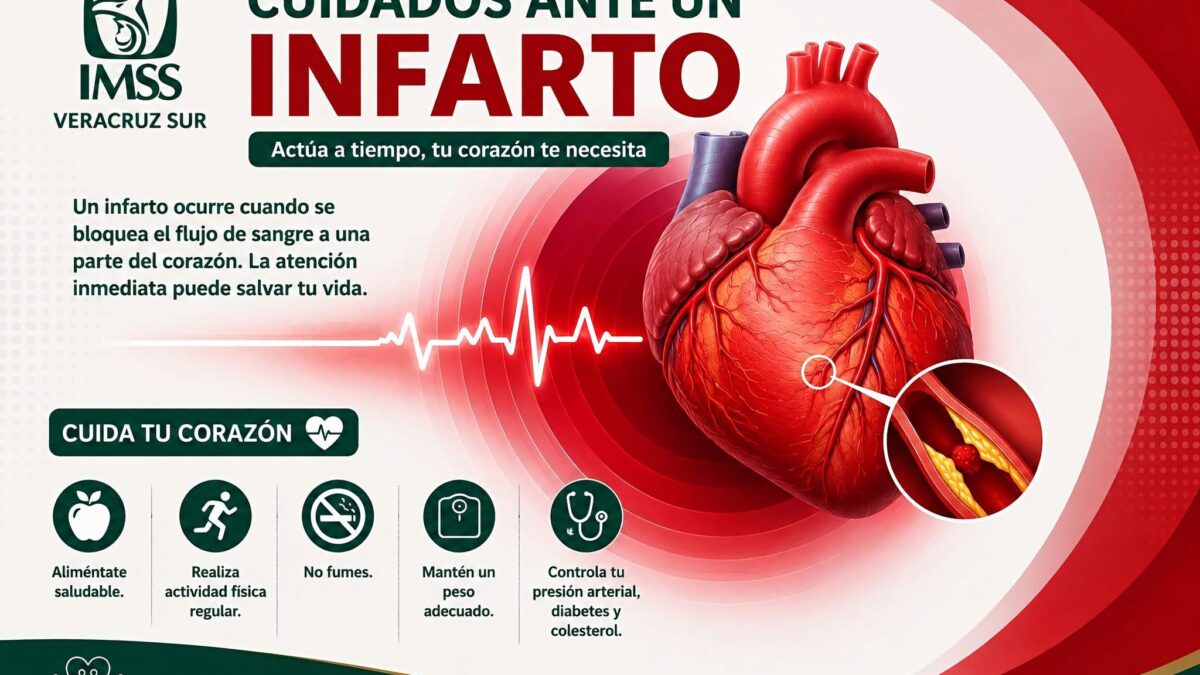 IMSS Veracruz Sur alerta sobre síntomas de infarto